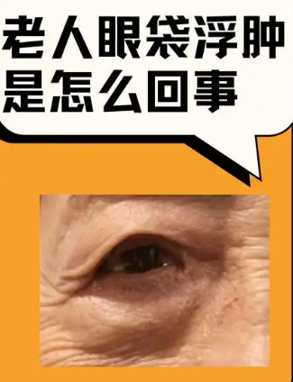 去眼袋手术