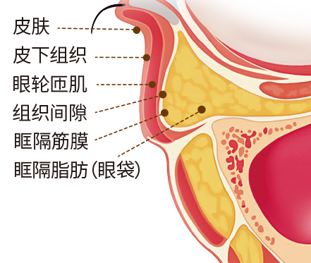 去眼袋手术