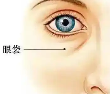 去眼袋手术