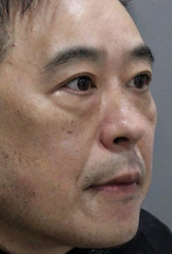 去眼袋手术