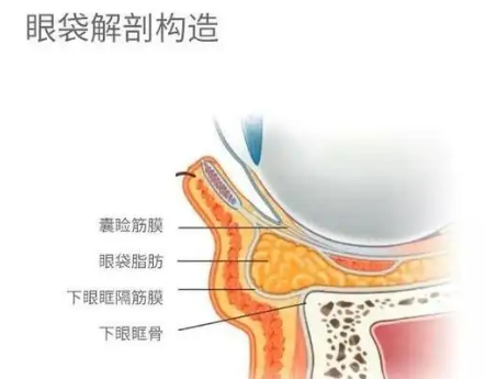 去眼袋手术