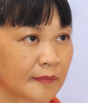 去眼袋手术