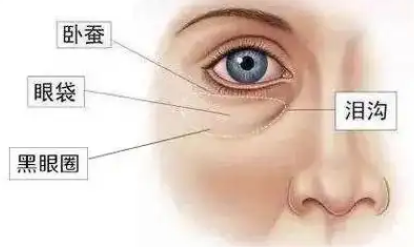 泪沟