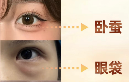 眼袋
