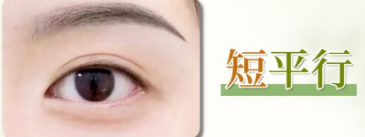 双眼皮