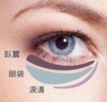 去眼袋手术