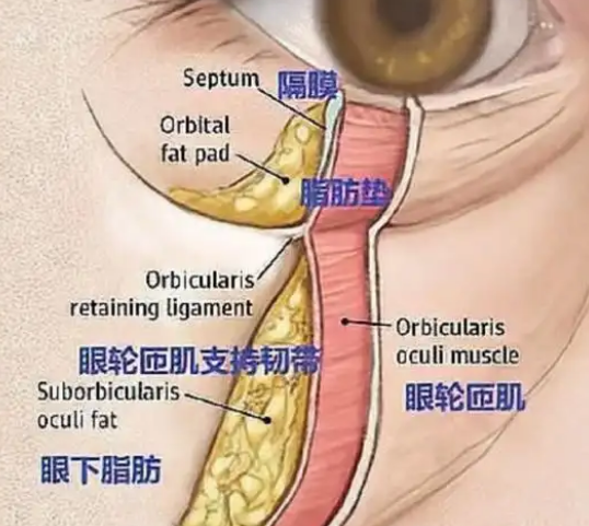 眼袋