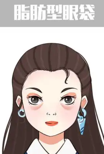 眼袋