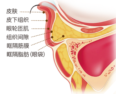 去眼袋手术