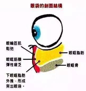 去眼袋手术