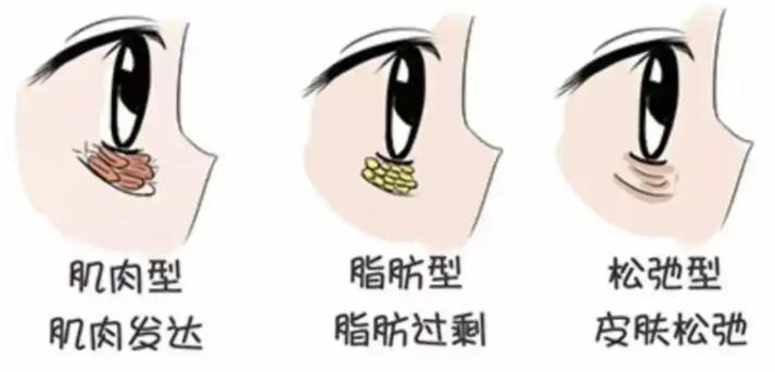 眼袋