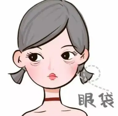 去眼袋手术