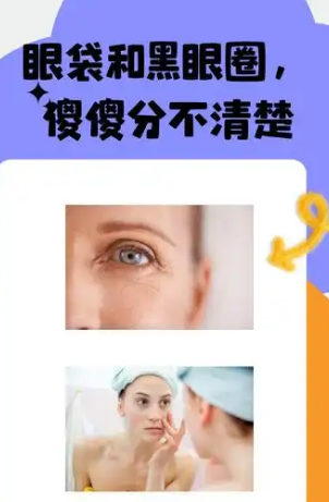眼袋