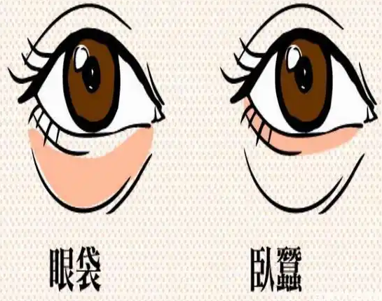 去眼袋手术