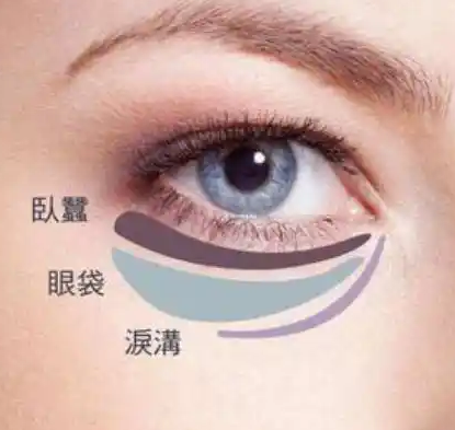 去眼袋手术