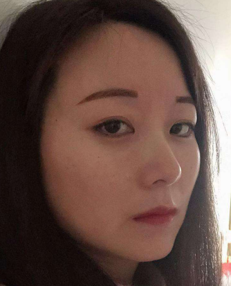 眼袋