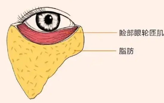 去眼袋手术