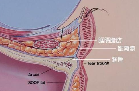 眼袋