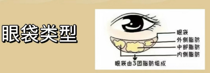 眼袋