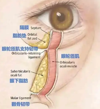 去眼袋手术