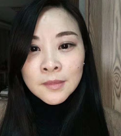 去眼袋手术