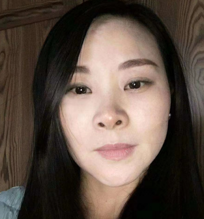 去眼袋手术