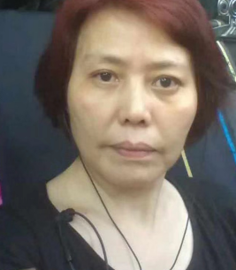去眼袋手术