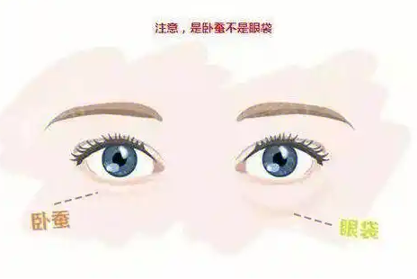去眼袋手术