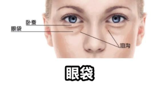 眼袋