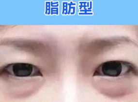 眼袋