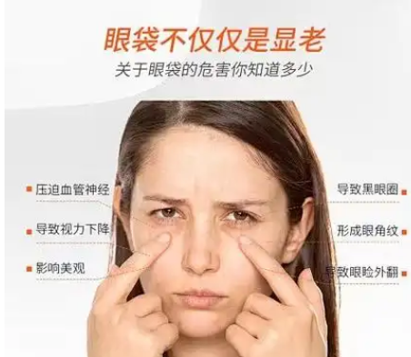 去眼袋手术