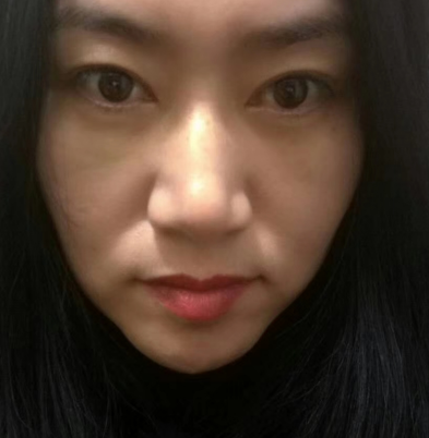 去眼袋手术