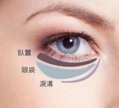 去眼袋手术