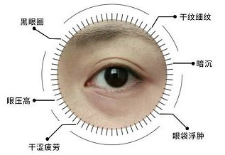 去眼袋手术