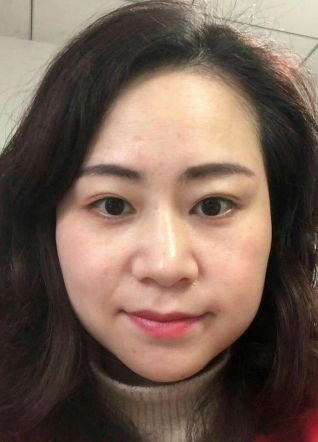 去眼袋手术