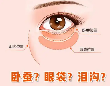 去眼袋手术