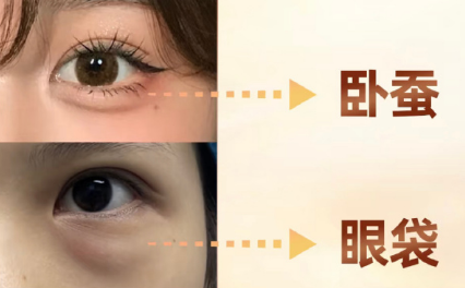眼袋