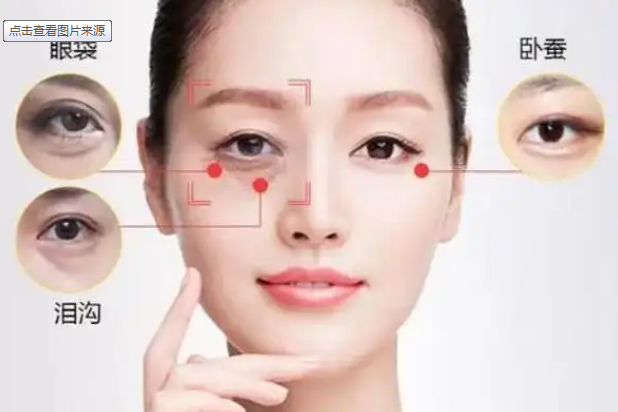 眼袋