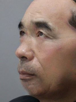 去眼袋手术