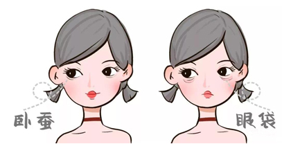 去眼袋手术