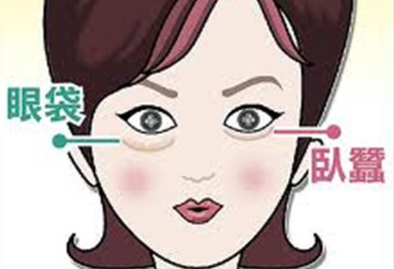 去眼袋手术