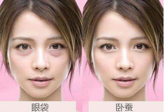 眼袋