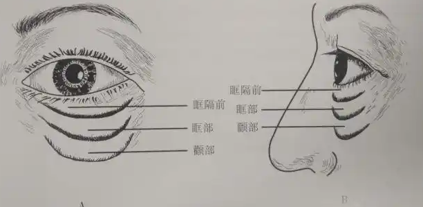 眼袋
