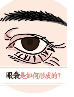 去眼袋手术