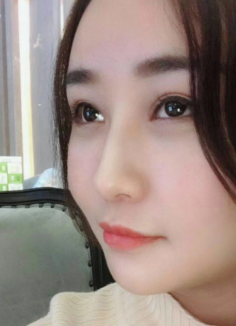 去眼袋手术