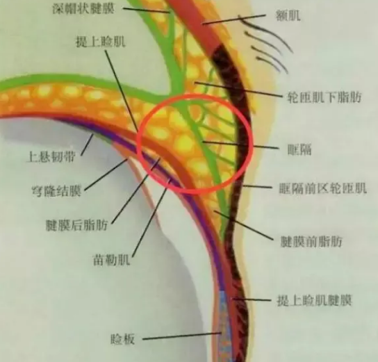 眼袋