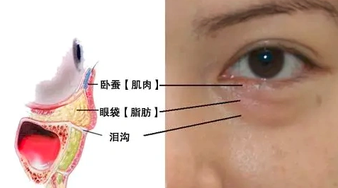 眼袋