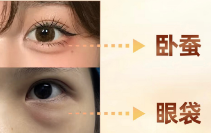 眼袋