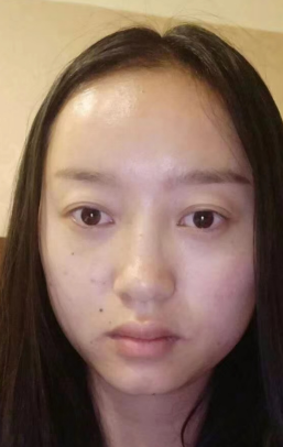 眼袋