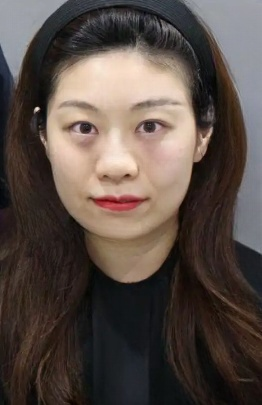 去眼袋手术